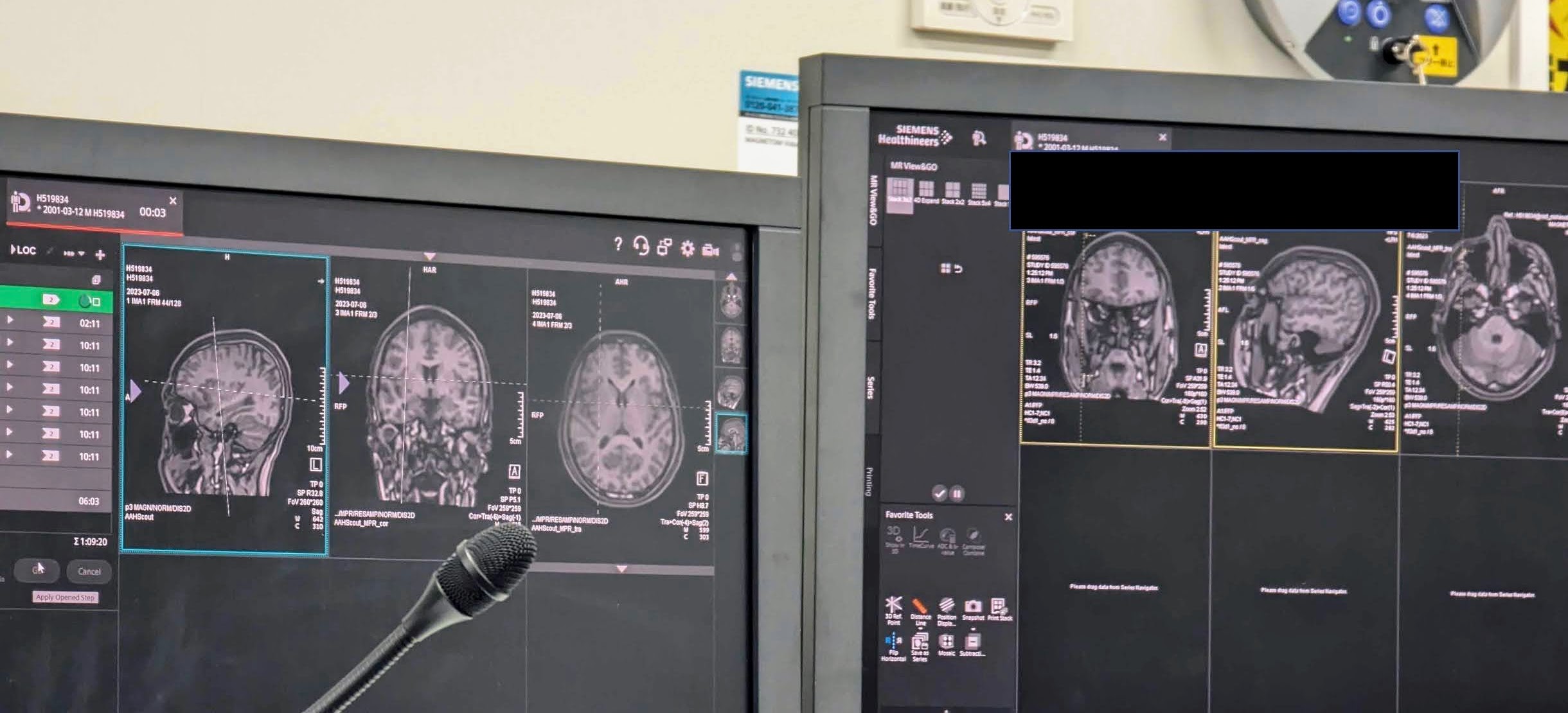 fMRI scan monitoring
